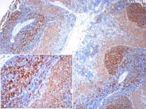 HLA-DR Recombinant Rabbit Monoclonal Antibody