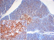 HLA-DR Recombinant Rabbit Monoclonal Antibody