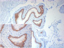 Integrin alpha 2 Recombinant Rabbit  Monoclonal Antibody