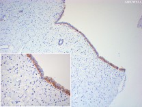 Integrin alpha 2 Recombinant Rabbit  Monoclonal Antibody