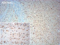 Bcl-2 Recombinant Rabbit Monoclonal  Antibody