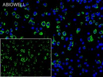 SQSTM1/p62 Recombinant Rabbit Monoclonal Antibody