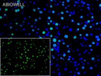 STAT3 Recombinant Rabbit Monoclonal Antibody