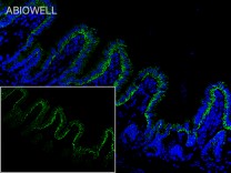 Integrin alpha 2 Recombinant Rabbit  Monoclonal Antibody