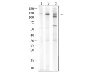 CD31 Recombinant Rabbit Monoclonal Antibody