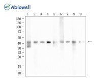 α-SMA Recombinant Rabbit Monoclonal Antibody