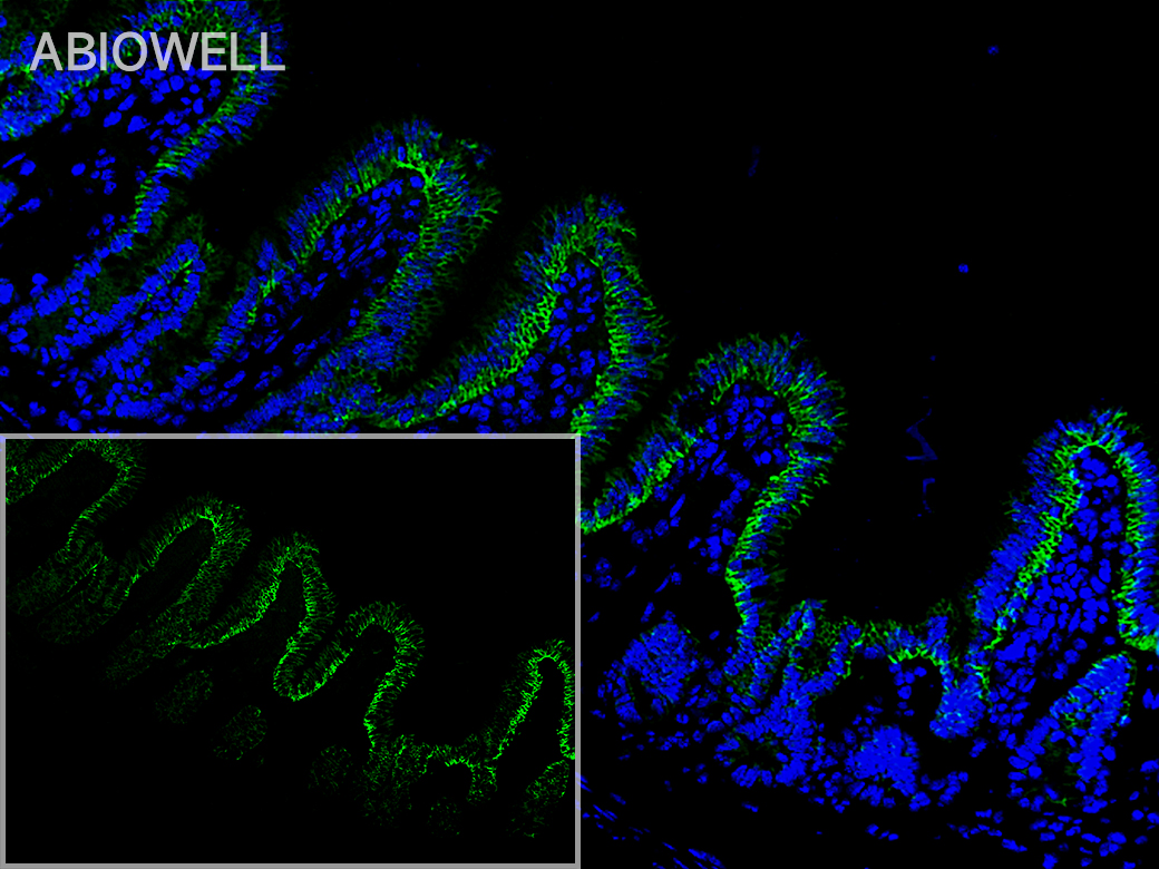 Fig: Fluorescence immunohistochemical analysis of Mouse-ileum tissue (Formalin/PFA-fixed paraffin-embedded sections). with Rabbit anti-Integrin alpha 2 antibody (AWA12676) at 1/200 dilution.

The immunostaining was performed with the TSA Immuno-staining Kit (ABIOWELL, AWI0688). The section was pre-treated using heat mediated antigen retrieval with EDTA buffer (pH 9.0) for 20 minutes. The tissues were blocked in 5% BSA for 60 minutes at 37℃, washed with ddH2O and PBS, and then probed with the primary antibody (AWA12676) at 1/200 dilution for 1 hour at room temperature. The detection was performed using an HRP conjugated compact polymer system followed by a separate fluorescent tyramide signal amplification system (green). DAPI (blue, AWC0291) was used as a nuclear counter stain. Image acquisition was performed with  Slide Scanner.