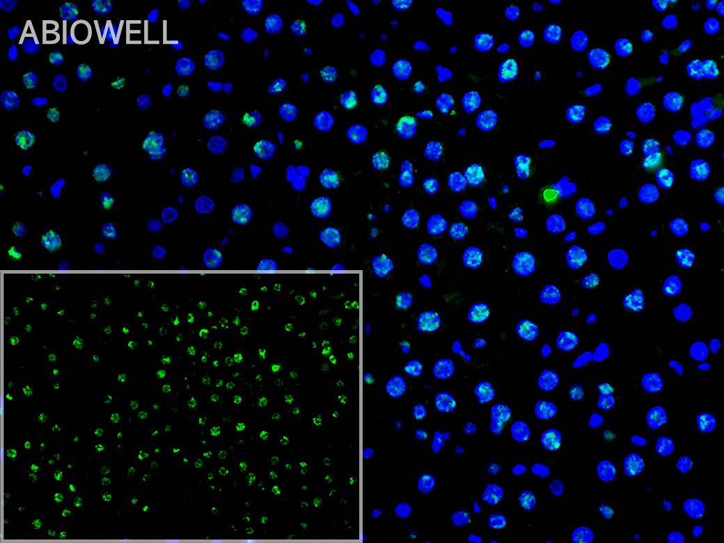 Fig: Fluorescence immunohistochemical analysis of Rat-Liver  Tissue (Formalin/PFA-fixed paraffin-embedded sections). with Rabbit anti-STAT3(phospho-S727)  antibody (AWA12673) at 1/200 dilution.

The immunostaining was performed with the TSA Immuno-staining Kit (ABIOWELL, AWI0688). The section was pre-treated using heat mediated antigen retrieval with EDTA buffer (pH 9.0) for 20 minutes. The tissues were blocked in 5% BSA for 60 minutes at 37℃, washed with ddH2O and PBS, and then probed with the primary antibody (AWA12673) at 1/200 dilution for 1 hour at room temperature. The detection was performed using an HRP conjugated compact polymer system followed by a separate fluorescent tyramide signal amplification system (green). DAPI (blue, AWC0291) was used as a nuclear counter stain. Image acquisition was performed with  Slide Scanner.