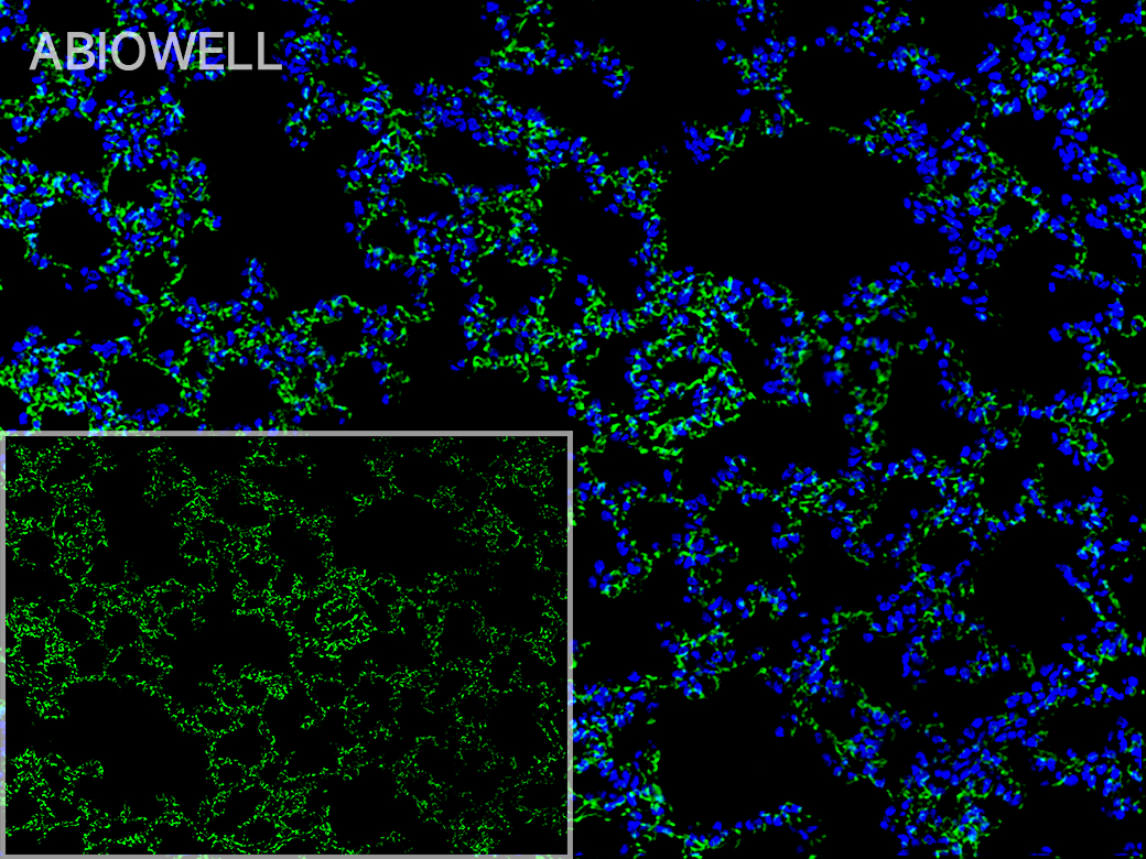 Fig: Fluorescence immunohistochemical analysis of Rat-lung (Formalin/PFA-fixed paraffin-embedded sections). with Rabbit anti-SREBP1 antibody (AWA43538) at 1/200 dilution.

The immunostaining was performed with the TSA Immuno-staining Kit (ABIOWELL, AWI0688). The section was pre-treated using heat mediated antigen retrieval with EDTA buffer (pH 9.0) for 20 minutes. The tissues were blocked in 5% BSA for 60 minutes at 37℃, washed with ddH2O and PBS, and then probed with the primary antibody (AWA43538) at 1/200 dilution for 1 hour at room temperature. The detection was performed using an HRP conjugated compact polymer system followed by a separate fluorescent tyramide signal amplification system (green). DAPI (blue, AWC0291) was used as a nuclear counter stain. Image acquisition was performed with  Slide Scanner.