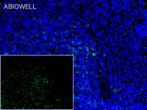 Bcl-2 Recombinant Rabbit Monoclonal  Antibody