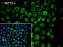 Parkin Recombinant Rabbit Monoclonal Antibody