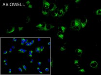 SQSTM1/p62 Recombinant Rabbit Monoclonal Antibody