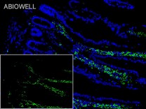 HLA-DR Recombinant Rabbit Monoclonal Antibody