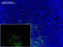 HLA-DR Recombinant Rabbit Monoclonal Antibody