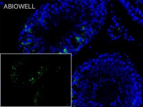 Bcl-XL Recombinant Rabbit Monoclonal  Antibody