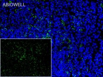 PTGER2 Recombinant Rabbit Monoclonal  Antibody