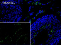 Bcl-2 Rabbit Polyclonal Antibody