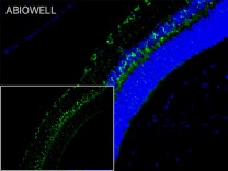 Nrf2 Rabbit Polyclonal Antibody