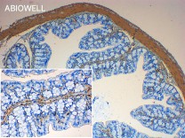 α-SMA Recombinant Rabbit Monoclonal Antibody