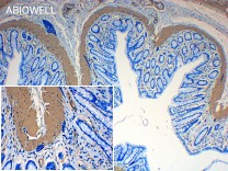 α-SMA Recombinant Rabbit Monoclonal Antibody