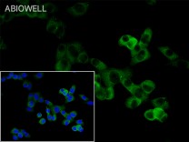 STAT3 Recombinant Rabbit Monoclonal Antibody