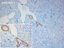 α-SMA Mouse Monoclonal Antibody