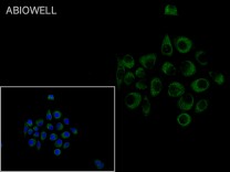 Ferritin Recombinant Rabbit Monoclonal  Antibody