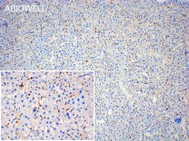 HO-1 Recombinant Rabbit Monoclonal Antibody