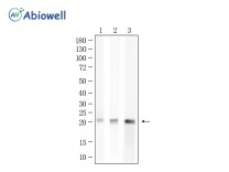 Ferritin Recombinant Rabbit Monoclonal  Antibody