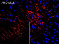 HO-1 Recombinant Rabbit Monoclonal Antibody