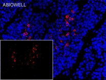 HO-1 Recombinant Rabbit Monoclonal Antibody