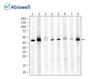 Cytokeratin 19 Rabbit Polyclonal Antibody