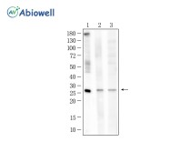 HMGB1 Rabbit Polyclonal Antibody