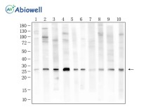 HMGB1 Rabbit Polyclonal Antibody