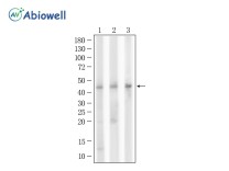 Cytokeratin 19 Rabbit Polyclonal Antibody