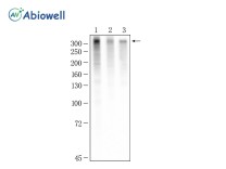 Ki67 Rabbit Monoclonal Antibody