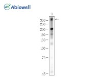 Ki67 Rabbit Monoclonal Antibody