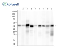 α-SMA Mouse Monoclonal Antibody