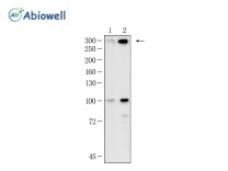 Aggrecan Recombinant Rabbit Monoclonal  Antibody