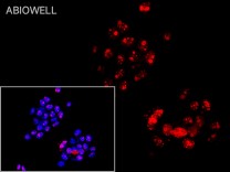 Ki67 Rabbit Monoclonal Antibody