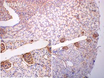 CD31 Recombinant Rabbit Monoclonal Antibody