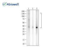 C3 Recombinant Rabbit Monoclonal  Antibody