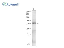 HER2/ErbB2 Rabbit Polyclonal Antibody