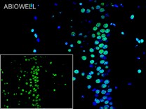 HMGB1 Recombinant Rabbit Monoclonal Antibody