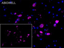 HPRT Recombinant Rabbit Monoclonal  Antibody