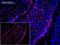 HPRT Recombinant Rabbit Monoclonal  Antibody