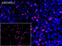 Ki67 Rabbit Monoclonal Antibody