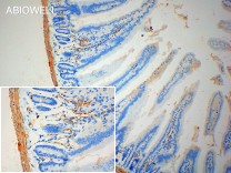 α-SMA Mouse Monoclonal Antibody