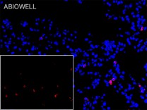 Bcl-2 Recombinant Rabbit Monoclonal  Antibody