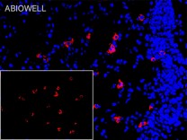 FACL4 Recombinant Rabbit Monoclonal Antibody